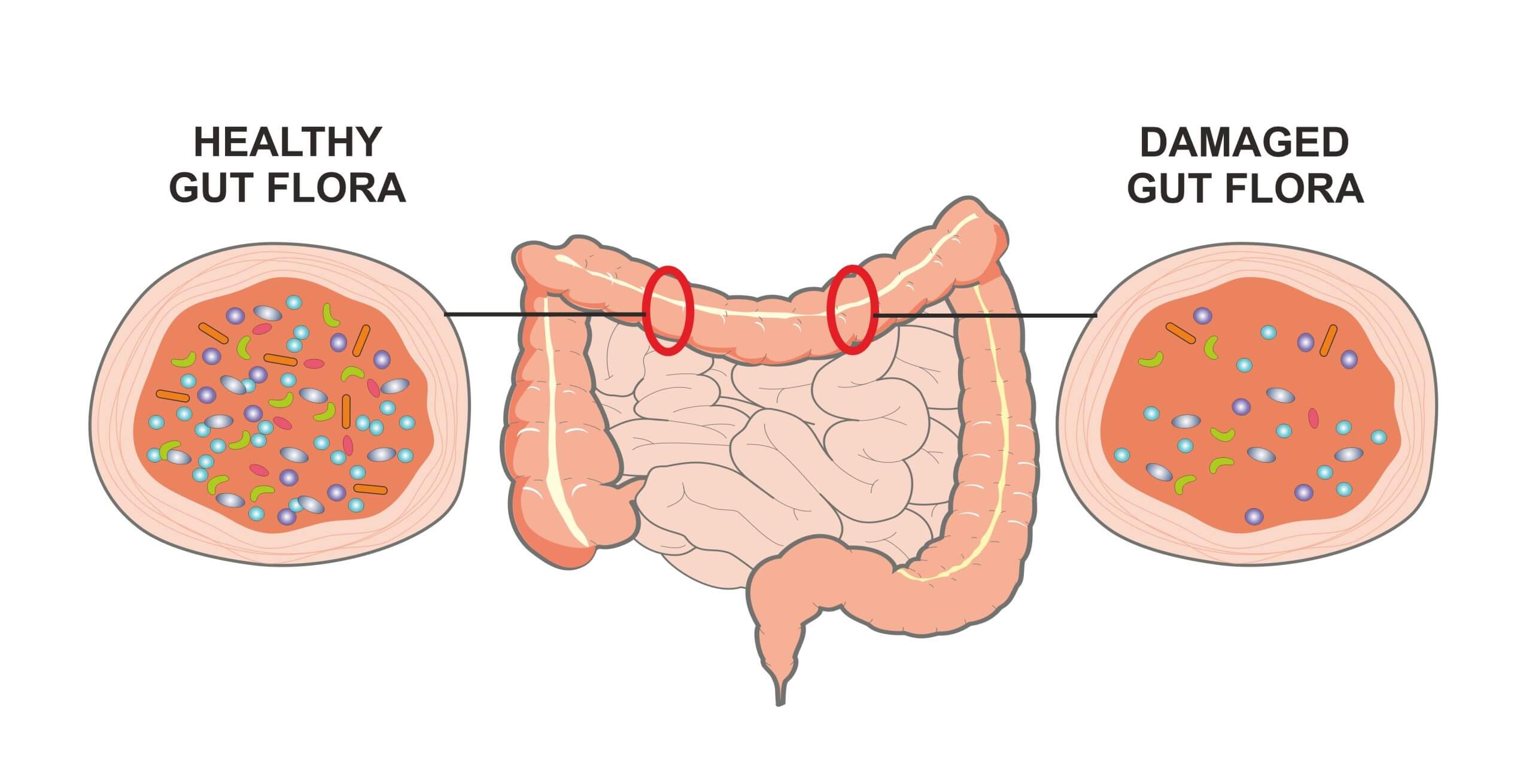 Enzyme và men tiêu hóa khác nhau thế nào?